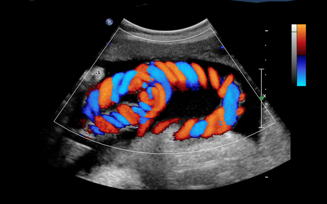 Υπερηχογράφημα-Ανάπτυξης-Doppler-1080x675